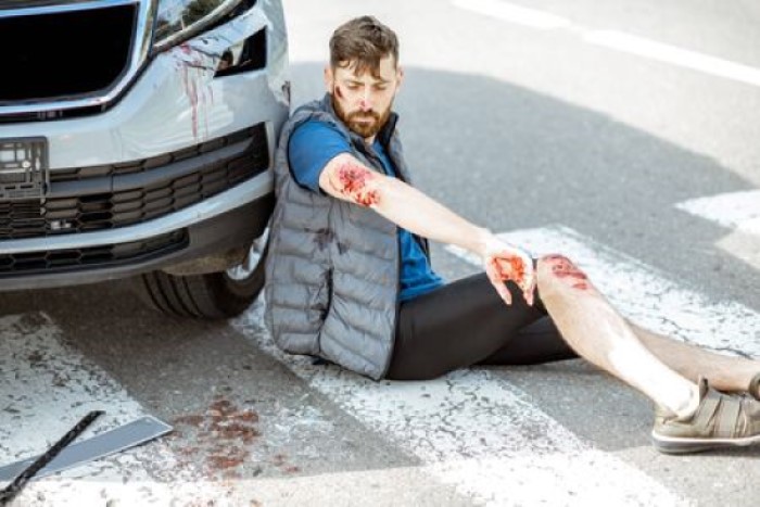 5 Reasons Pedestrians Hit By Cars Need A Lawyer 2 Pedestrians Hit By Cars